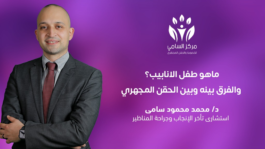 ماهو طفل الانابيب؟ والفرق بينه وبين الحقن المجهري