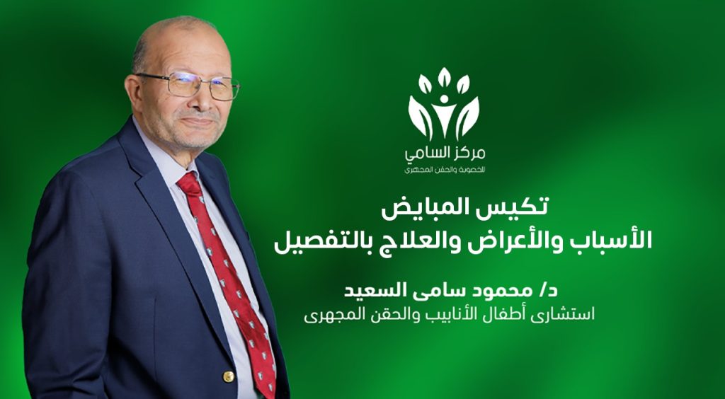 تكيس المبايض