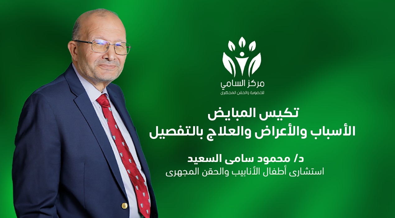 تكيس المبايض: الأسباب والأعراض والعلاج بالتفصيل
